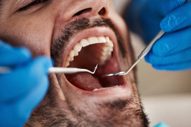 Best Periodontal (Gum) Disease Treatment  in Fairfield Harbour, NC